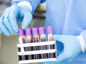 Вакцина против коронавируса, должна появиться в ближайшее время